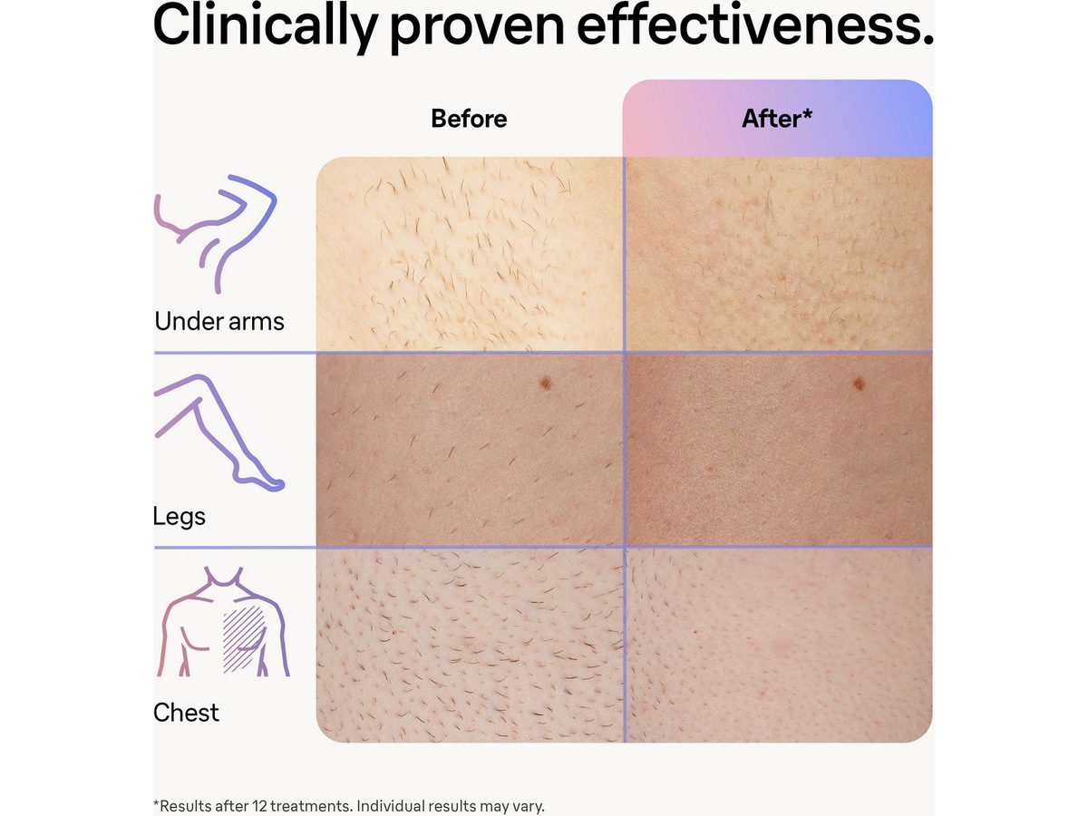 Braun Smart IPL Skin i·expert PL7253 (rosa) Epilator & IPL-hårborttagning