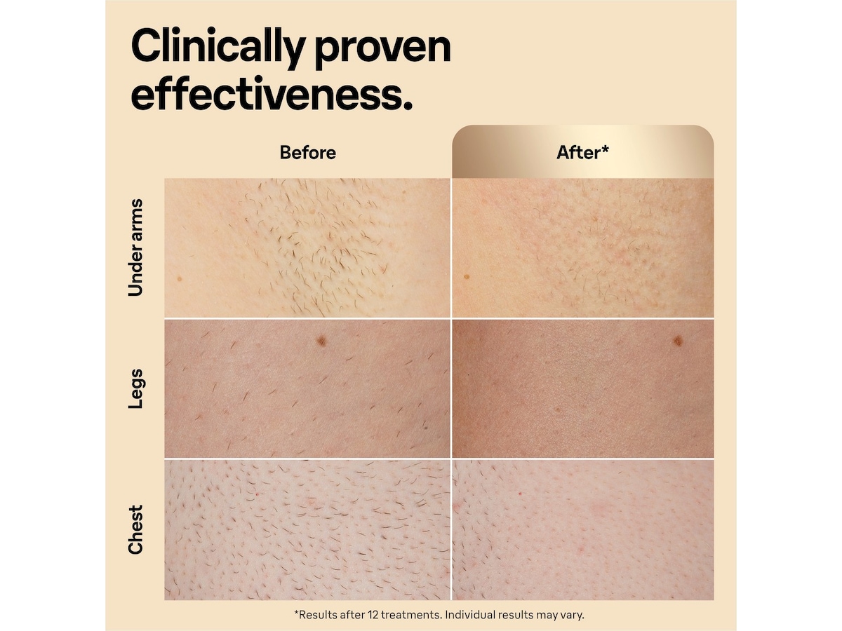 Braun IPL Silk·expert Pro 5 PL5242 (vit/guld) Epilator & IPL-hårborttagning