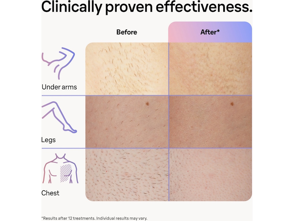 Braun Smart IPL Skin i·expert PL7253 (rosa) Epilator & IPL-hårborttagning