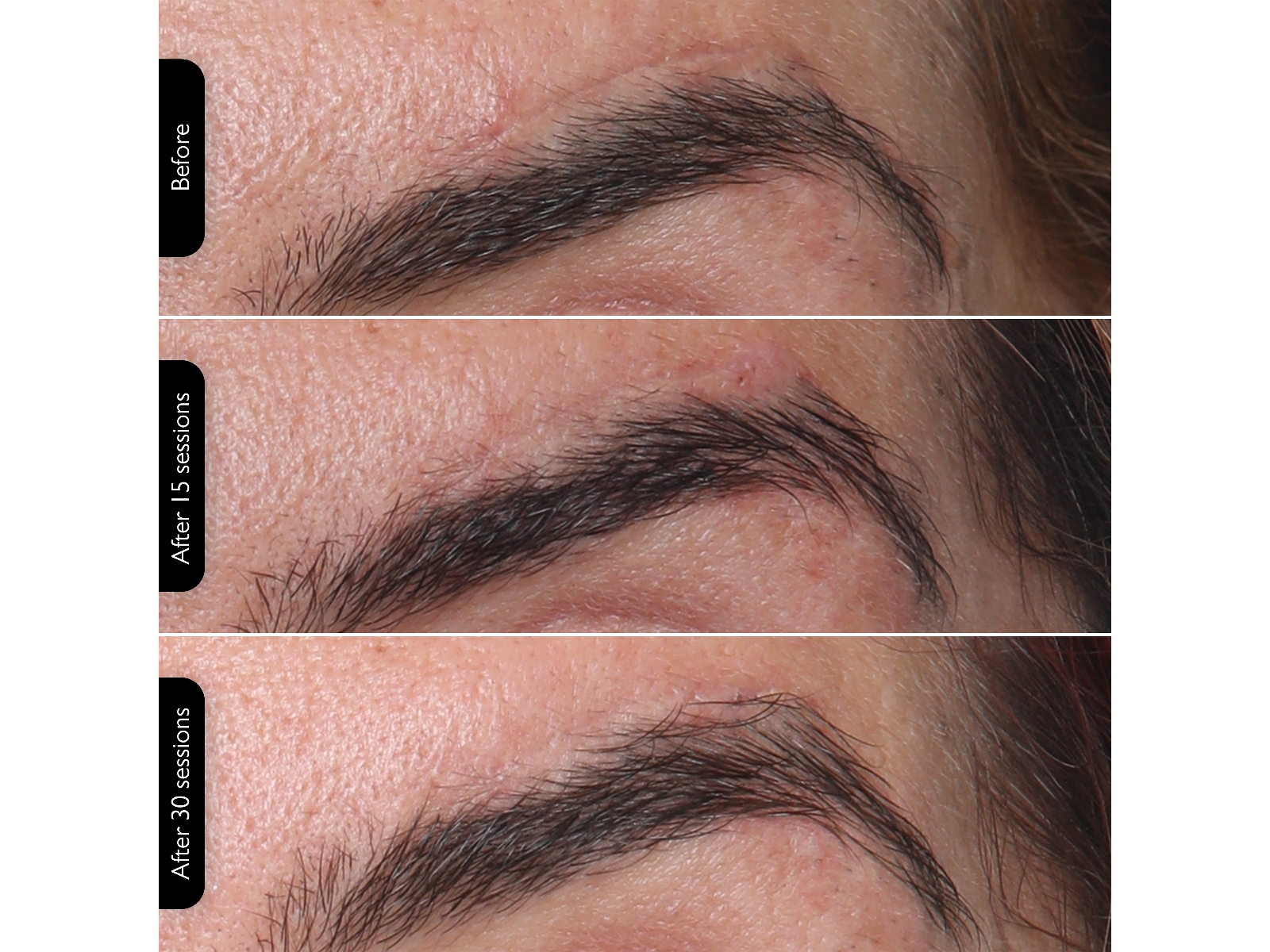 Silk'n Facial LED Mask Ansiktsbehandling