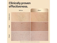 Braun IPL Silk·expert Pro 5 PL5242 (vit/guld) Epilator & IPL-hårborttagning