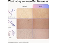 Braun Smart IPL Skin i·expert PL7253 (rosa) -B-Grade Demo träning & hälsa