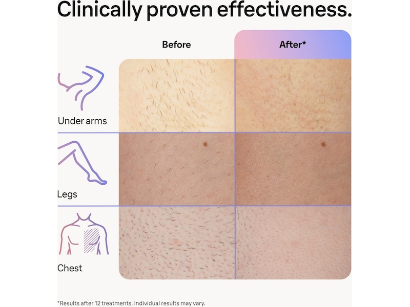 Braun Smart IPL Skin i·expert PL7253 (rosa) Epilator & IPL-hårborttagning