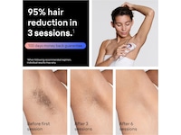 Braun IPL Skin i·expert PL7431 Epilator & IPL-hårborttagning